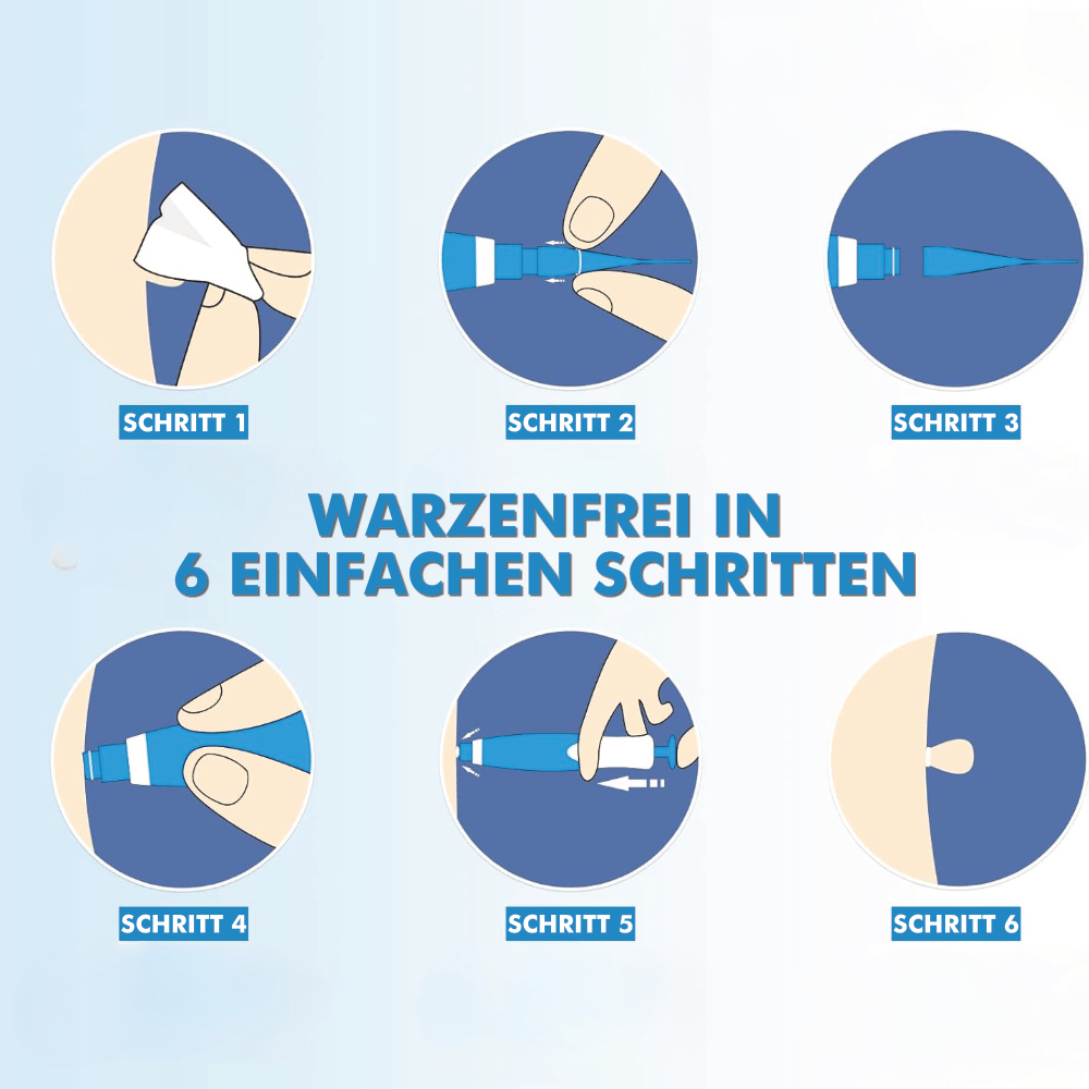 WarzenFrei - Der Stielwarzen Entferner