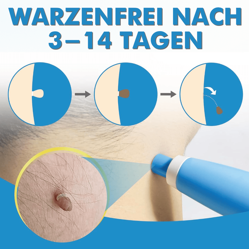 WarzenFrei - Der Stielwarzen Entferner