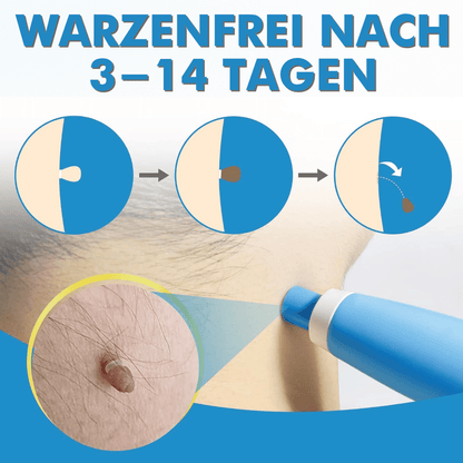 WarzenFrei - Der Stielwarzen Entferner